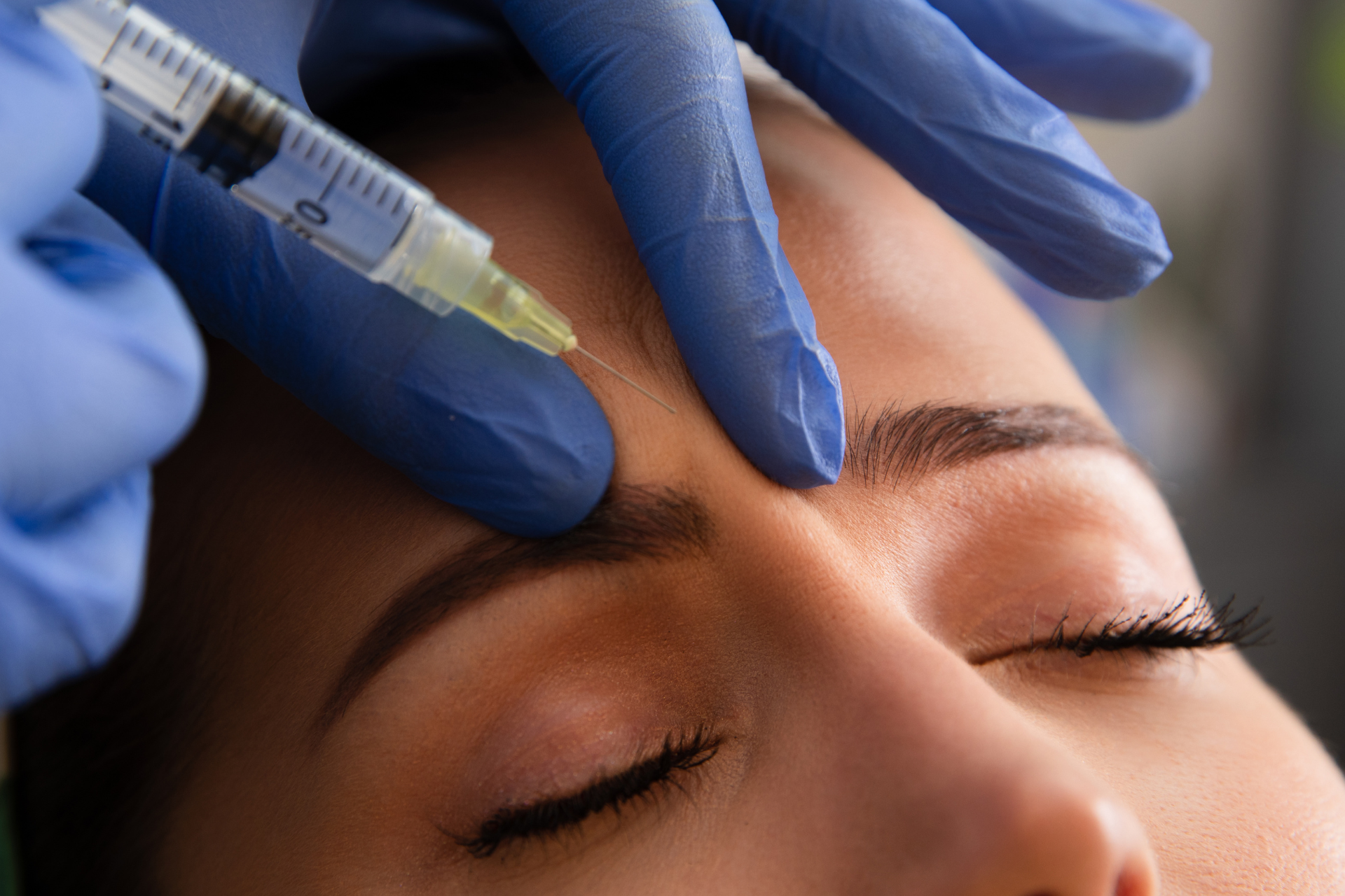 The Long-Term Benefits of Botox: Why Consistency is Key