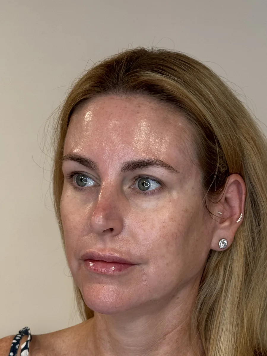 Full-Face Balancing after