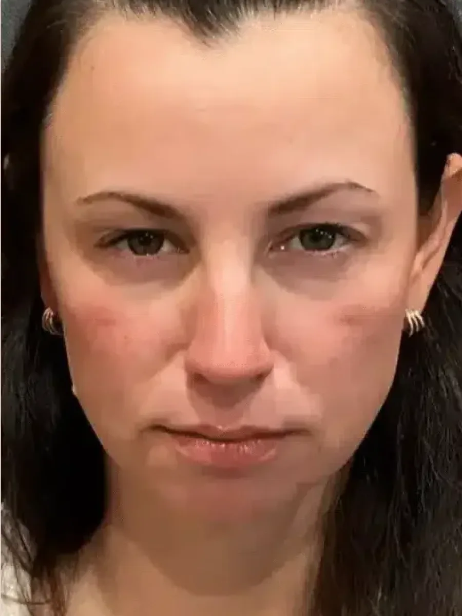 Full Refresh after — Esthetic Finesse