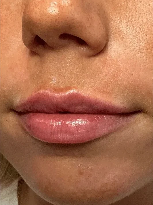 Shape and Symmetry after — Esthetic Finesse