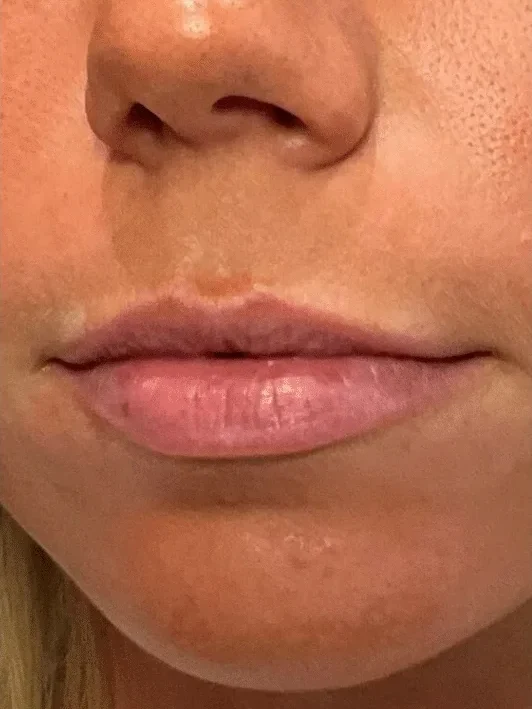 Shape and Symmetry before — Esthetic Finesse